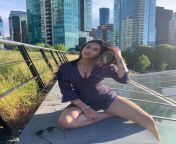 NRI Beautiful Thick Thighs of Desi Canadian Lady from desi hospital lady