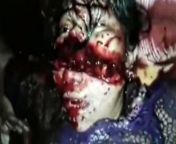 [50/50] A beautiful girl blushing (SFW) &#124; A woman&#39;s face brutally split in half (NSFW) from woman brutally beaten