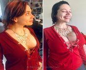 This was one of the first pictures I posted on Reddit right after my boobs were healed enough to wear normal clothes in without a bra. It’s probably the most accurate before and after as my boobs are in the same stage of dropping and fluffing in each pic! from indian stage boobs