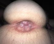 My fist time pumping my butt and does anybody know of communities just for ass pumping from extrem pumping