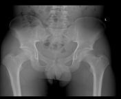 Any abnormalities with this X-ray image? from xossip actress x sex image sudar
