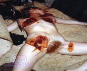 A murder case showing sex-related mutilation from girl raped murder deadbody nude sex vu