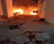 Urgent: 300 martyrand 220 others injured in an Israeli bombing targeting the Arab National Hospital in Gaza. It is noteworthy that the hospital receives the injured, and there are thousands of displaced people in its courtyards. from fake hospital in japanese