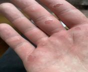 Did I go too hard first time bouldering or is this normal? from downloads shemale hard first time jobw