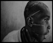 Rwanda, 1994 - Survivor of Hutu death camp. By James Nachtwey from rwanda xxg smal