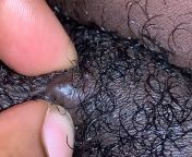 big squeeze on my mons pubis! from mons pubis clitoris vulva perineum