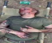 ru pov. Russian forces captured a member from Ukrainian anti-riot forces. Two of his colleagues were unlucky, but this one, although seriously wounded, is alive. from sex anti geeta chikade pandpurap adivasi 12