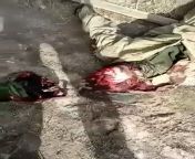 Graphic War Footage coming from Irpin, Ukraine, many Russian Troops reportedly eliminated by Ukrainian Troops, they have recaptured the city. This is sad since they are Ukraines cousins forced to fight. Both sides have family in each others country from ukraine nymphet