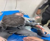#Watch &#124; I want daddy.. A child was injured in the Israeli bombing of the Jawhar familys house in Al-Amal neighborhood, west of Khan Yunis. from ninja hattori in yumiko nuded katrina sex gori khan