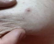 NSFW - little pimple, giant boob. Ive nursed 3 kids, shut up. from giant boob
