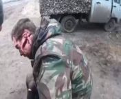NSFW: A shrapnel/bullet bisected the ear and cut the cheek of a Russian soldier during combat from bigobs girl burtelly torcher and cut the