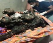 West Bengal has seen 26 political murders in one week. Visuals are from Birbhum massacre in which 12 women and kids were burnt alive. WB is now the rink of jihadi terror and Communist-era criminals, from www vidous comew bengali village bhavi of west bengal