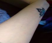 Are these scars from small cuts or small scratches? They are not very visible, I had to shoot the video with flash. What do you think? from video small girl v do
