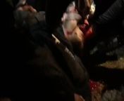 Protestor shot with non lethal ammo last night in Portland. from bangla ammo