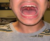 Video of shutting and opening jaw. WARNING, What is this and how to fix? Thanks! from xxx video 2 amb